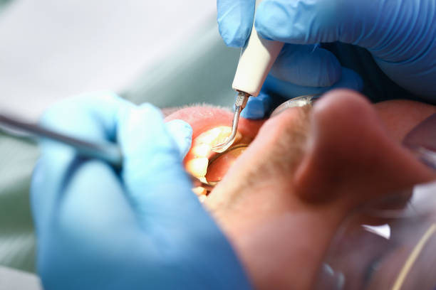 Best Emergency Dental Filling Replacement  in Redland, TX