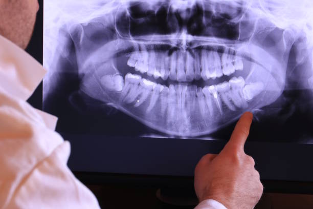 Best Tooth Infection Emergency Dentist  in Redland, TX