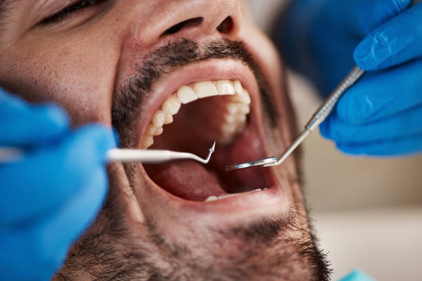 Best Chipped Tooth Repair Near Me  in Redland, TX